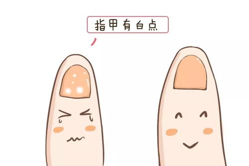 麻豆视频在线网站品牌告诉你指甲上有白点是缺哪种微量元素