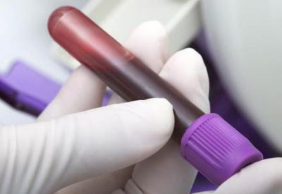 微量元素测试仪介绍铅中毒危害 微量元素测试仪介绍铅中毒危害