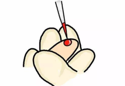 采样抽血检查微量元素的方法准确吗 采样抽血检查微量元素的方法准确吗